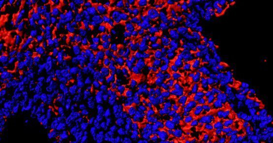 Study reveals link between starch digestion gene, gut bacteria
